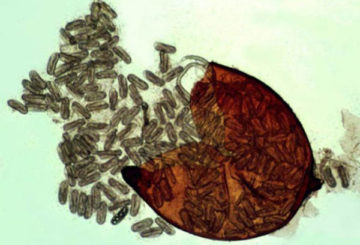 Kyste de nématode écrasé sous un microscope