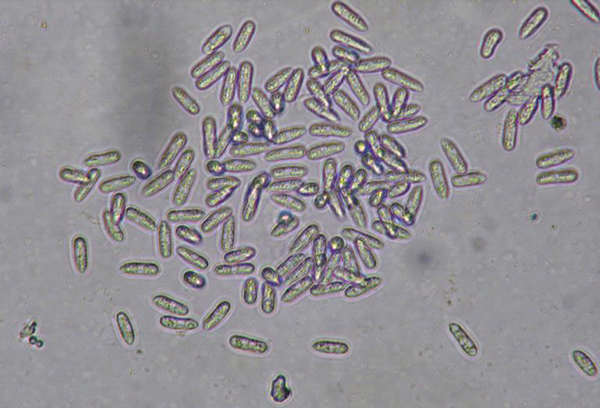 Champignon Colletotrichum orbiculare